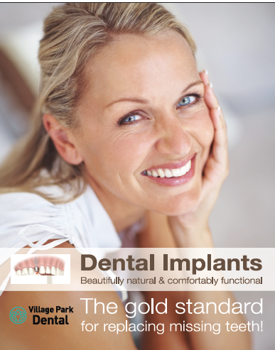 Dental Implant Poster by Identitynamebrands | Business Posters In Toronto